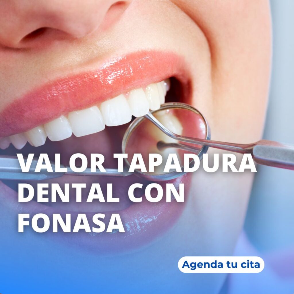 precio de tapadura con fonasa